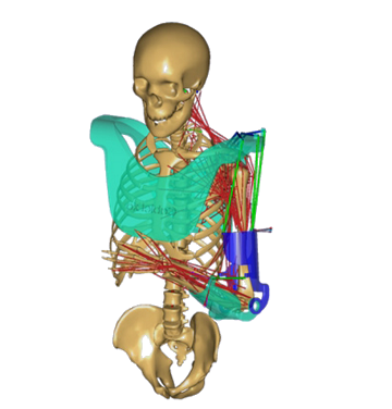 Brakial pleksus yaralanması için geliştirilmiş pasif eksoskeleton (Shaoping Bai)